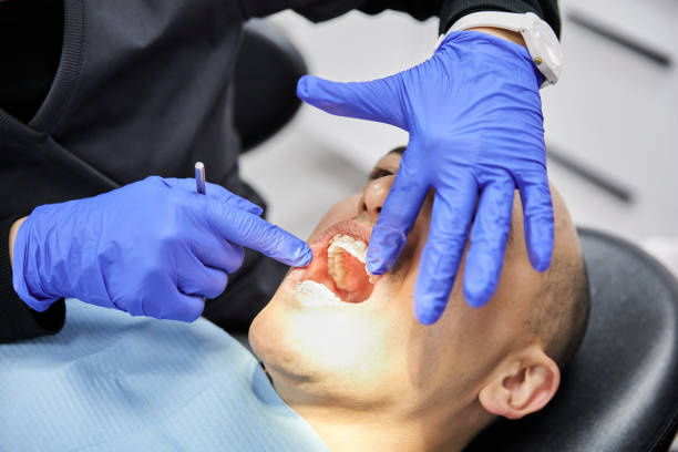 Best Emergency Dental Care for Sports Injuries in Mayfield Heights, OH